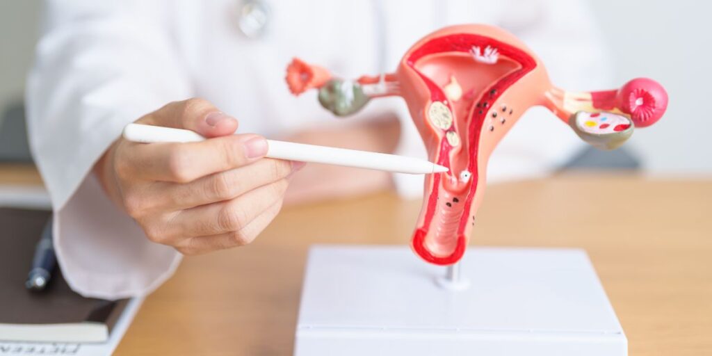 homeopathic treatment for fibroids in uterus