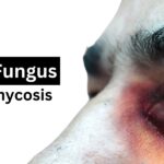 homeopathic medicine for black fungus