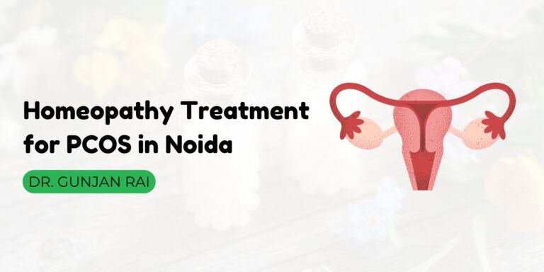Homeopathy Treatment for PCOS in Noida