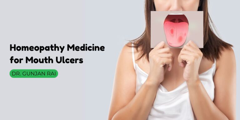 homeopathy medicine for mouth ulcers