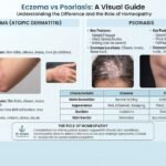 Infographic comparing eczema and psoriasis symptoms, visual characteristics, and the role of homeopathy, featuring side-by-side skin photos and a comparison table.